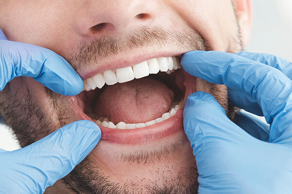 dental bonding - McKinney Dentist Dentist in McKinney