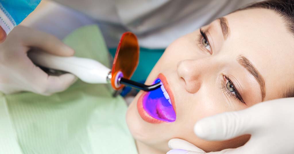 What to Expect for a Cavity Filling When You Visit the Dentist
