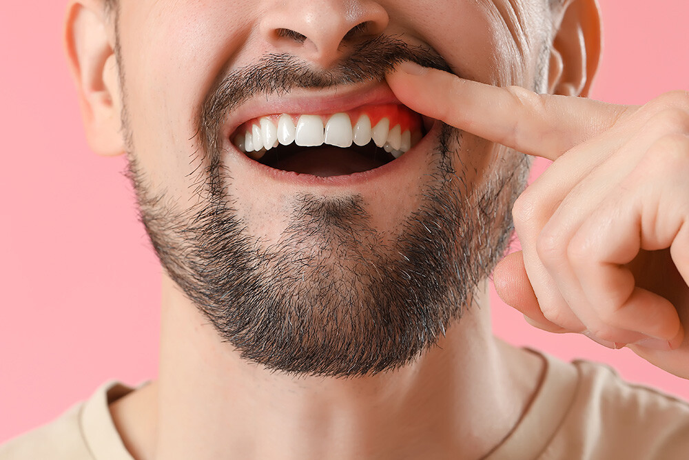 My Gums are Swollen Around One Tooth – What Could It Be?
